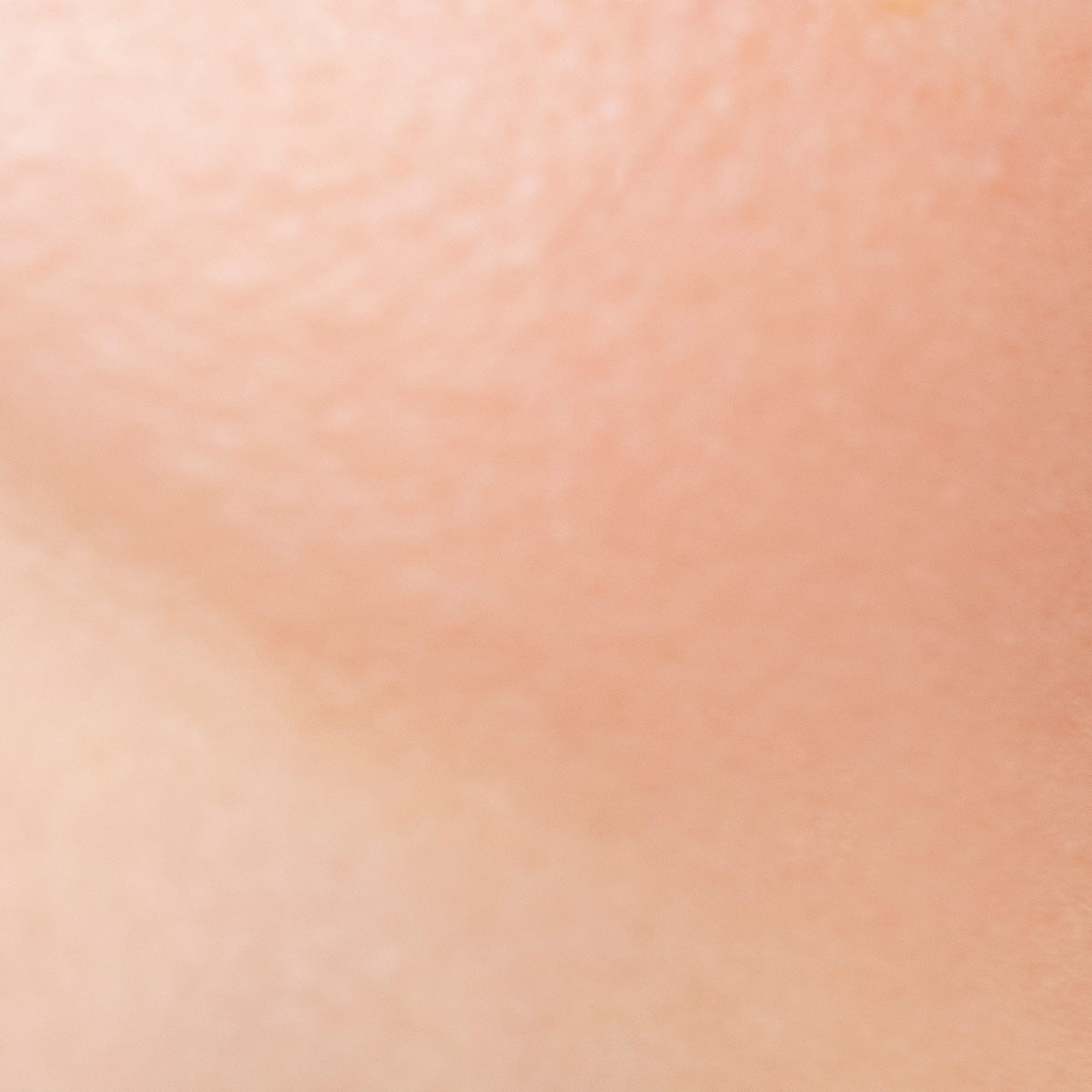 Normal Skin