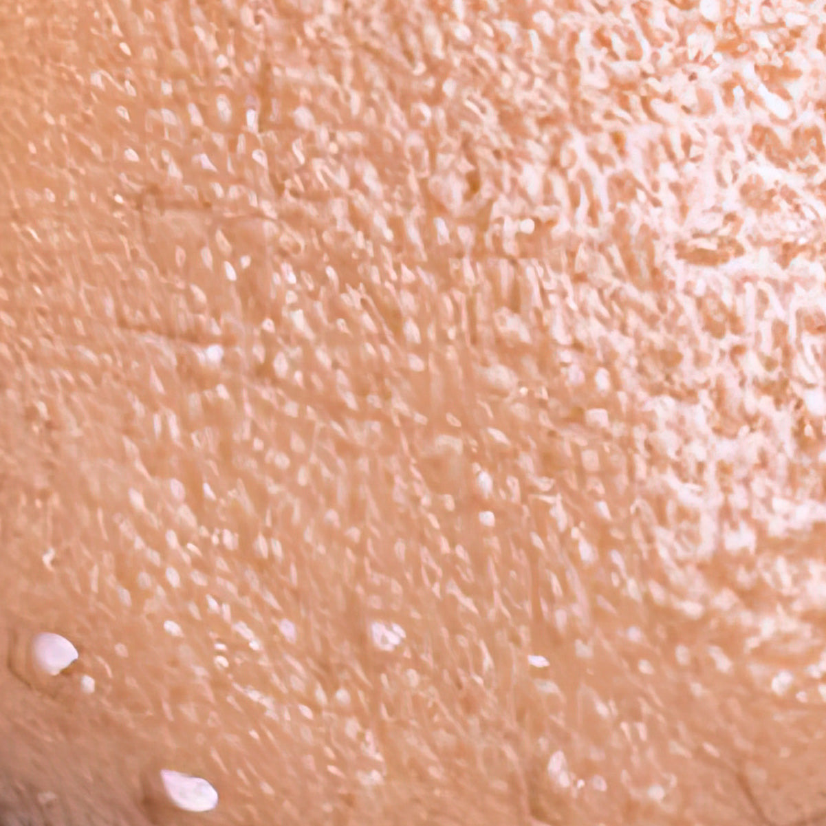 Oily Skin